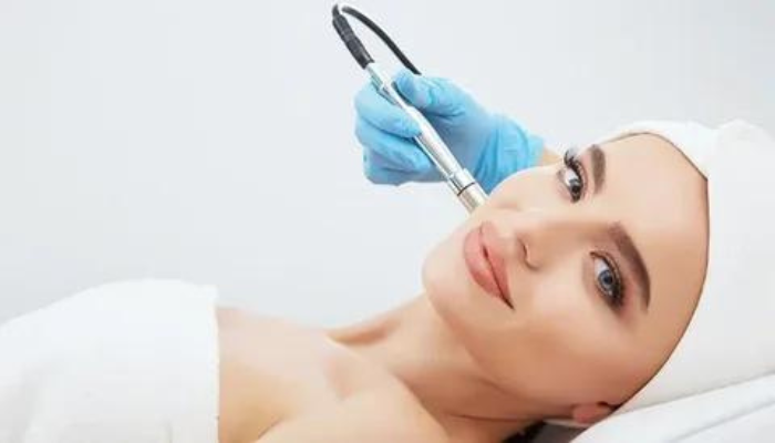 Microdermabrasion