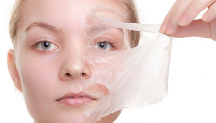 Chemical Peel