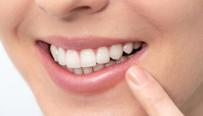 Be Cautious with Teeth-Whitening Products
