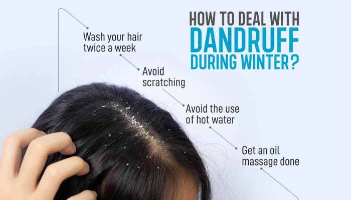 1. Understanding the Dandruff-Winter Connection