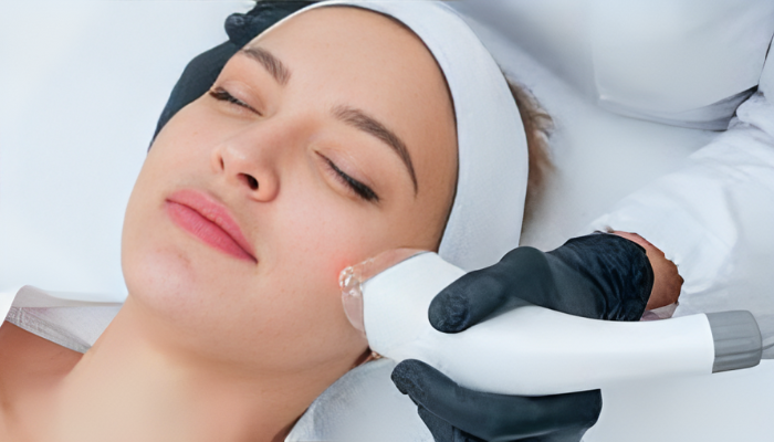 A Mix of Lasers: Enhancing Skin Health Through Complementary Procedures