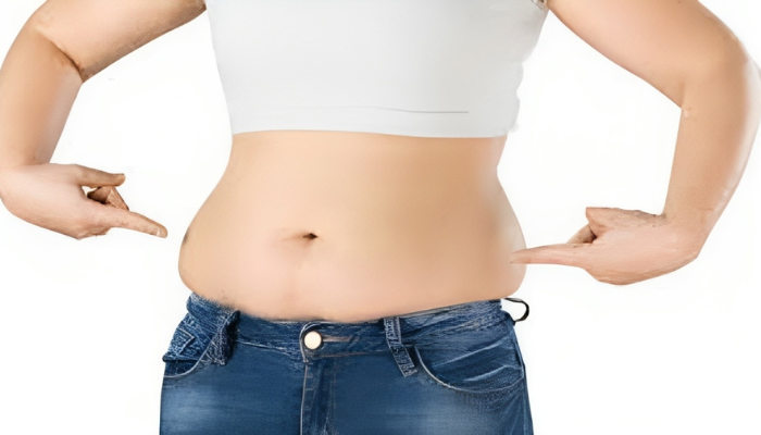 What Is Belly Fat?