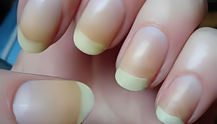 Signs of Unhealthy Nails